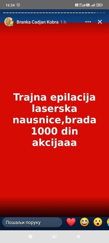 Entertainment: Laserska trajna epilacija – akcijske cene: - Nausnice i brada: 1.000 — 1