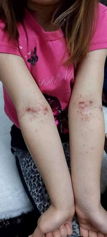 zenske kozne helanke: Ide leto,deca su u majicama i sorcicima. Padovi sa — 8
