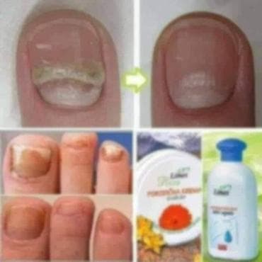 ps bluze i majice: Limes Rosa Porodična krema – kantarion i neven Višenamenska krema za — 7