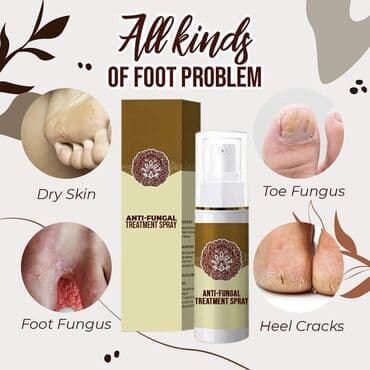 Cena 1090 din Sprej za stopala Sprej protiv gljivica na stopalima na lalafo.rs Cena 1090 din Sprej za stopala Sprej protiv gljivica na stopalima