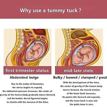 Anatomski pojas za trudnice sa naramenicama, koji služi kao ortopedsko — 8