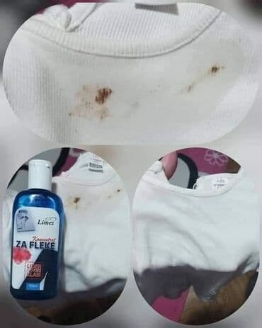 noša kao wc šolja: ✨ rešite se fleka bez muke! Koncentrat za fleke 150 ml – moćna formula — 7