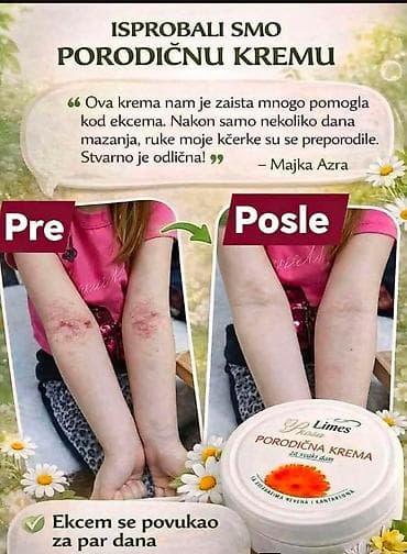 Nega kože: Nemojte ići na plažu bez ove kreme 🤗 🌿 PORODIČNA KREMA – melem koji — 3