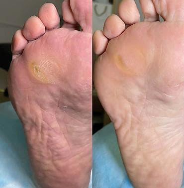 maseri beograd: ✨ FootCare Beograd ✨ Premium nega stopala u samom centru grada 👣 — 3