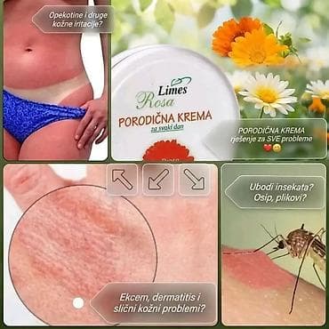 Nega kože: Nemojte ići na plažu bez ove kreme 🤗 🌿 PORODIČNA KREMA – melem koji — 9