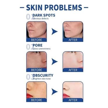 avon vitamin c serum: Cena 890 dinara Serum za lice za izbeljivanje pega i tamnih mrlja — 6