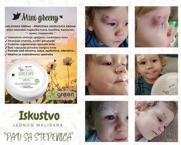 set za manikir i pedikir lidl: Nega kože — 1