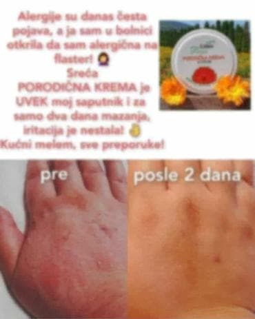 ps bluze i majice: Limes Rosa Porodična krema – kantarion i neven Višenamenska krema za — 2