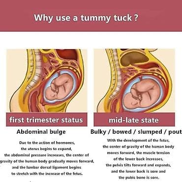 auto pojas za trudnice: Anatomski pojas za trudnice sa naramenicama, koji služi kao ortopedsko — 4