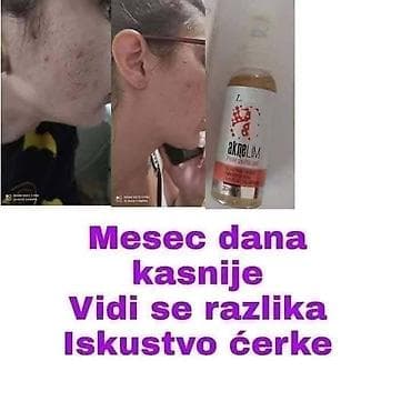 sinsay kožne jakne: Aknelim gel 30ml – 100% delotvoran saveznik protiv akni Iskoristite — 8