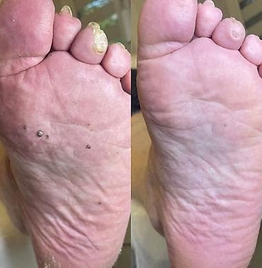 maseri beograd: ✨ FootCare Beograd ✨ Premium nega stopala u samom centru grada 👣 — 2