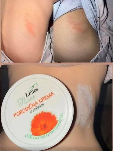 zenske kozne helanke: Ide leto,deca su u majicama i sorcicima. Padovi sa — 2