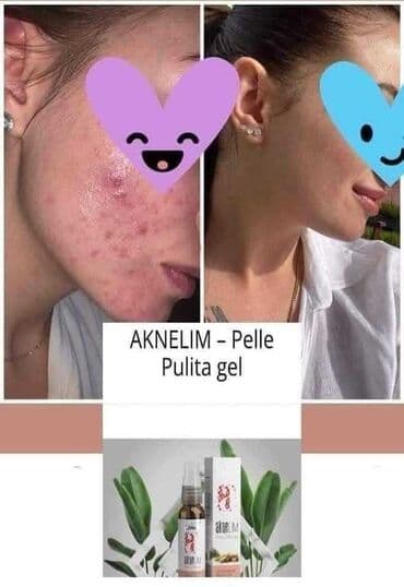 sapun za brijanje: AkneLim gel za čistu kožu u pakovanju sa pumpicom i pripadajućom — 2