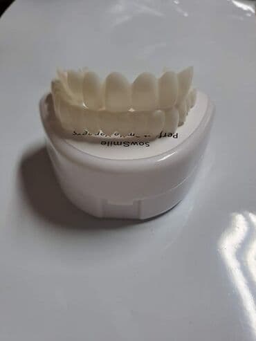 zlatne navlake za zube: Snap on Smile navlake za zube
Cena:3000din/par — 4