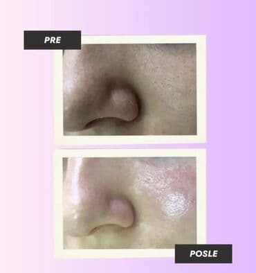 set sminke u koferu: 100%Prirodna Kozmetika Imas problem s licem, javi mi se u inbox i — 2
