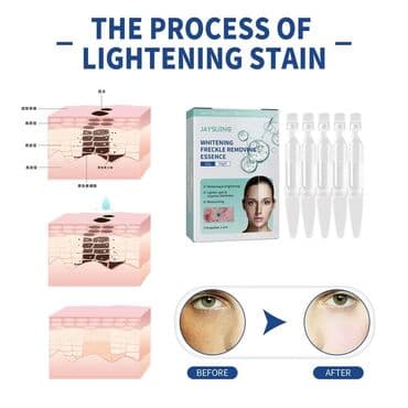 avon vitamin c serum: Cena 890 dinara Serum za lice za izbeljivanje pega i tamnih mrlja — 1