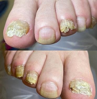 maseri beograd: ✨ FootCare Beograd ✨ Premium nega stopala u samom centru grada 👣 — 7