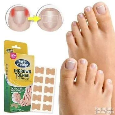 guess torba mala: Flasteri za urasle nokte – korektivne trakice za podizanje ivica nokta — 3