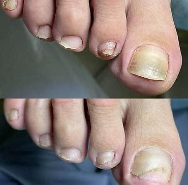 ✨ FootCare Beograd ✨ Premium nega stopala u samom centru grada 👣