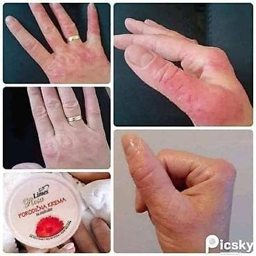 gucci majica cena: Limes Rosa Porodična krema – neven i kantarion Višenamenska krema za — 8