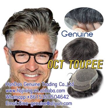 la force obuca: OCT Hair Replacement System for Men French Lace PUwhatsapp — 1