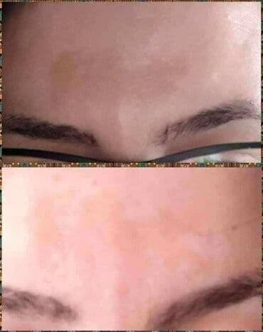 Iskustvo korisnice 🌹 Ovo je moje lično iskustvo sa Limes 21 kremom –