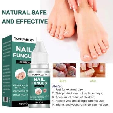 limes za gljivice na noktima: Cena 950 din Serum za uklanjanje gljivica 10ml Protiv infekcija, za — 1