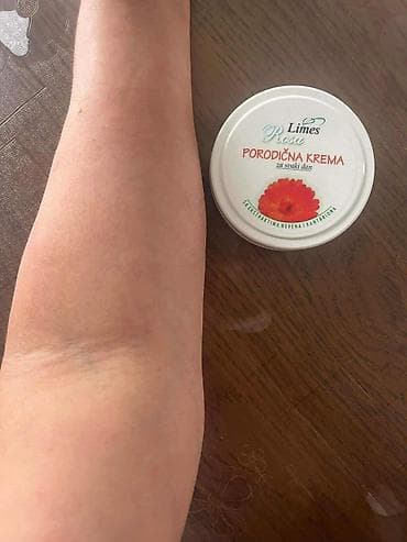 zenske kozne helanke: Ide leto,deca su u majicama i sorcicima. Padovi sa — 7