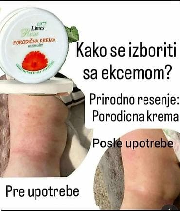 zenske kozne helanke: Ide leto,deca su u majicama i sorcicima. Padovi sa — 3