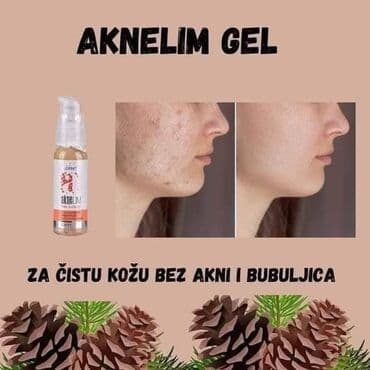 Perfumes: Aknelim gel 30ml – 100% delotvoran saveznik protiv akni Iskoristite — 8