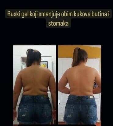 naramenice cena: ✨ Zategnuta koža i glatke noge nisu više san! Uz The Body Lab — 8