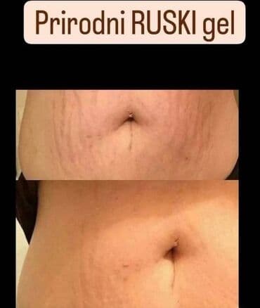 naramenice cena: ✨ Zategnuta koža i glatke noge nisu više san! Uz The Body Lab — 3