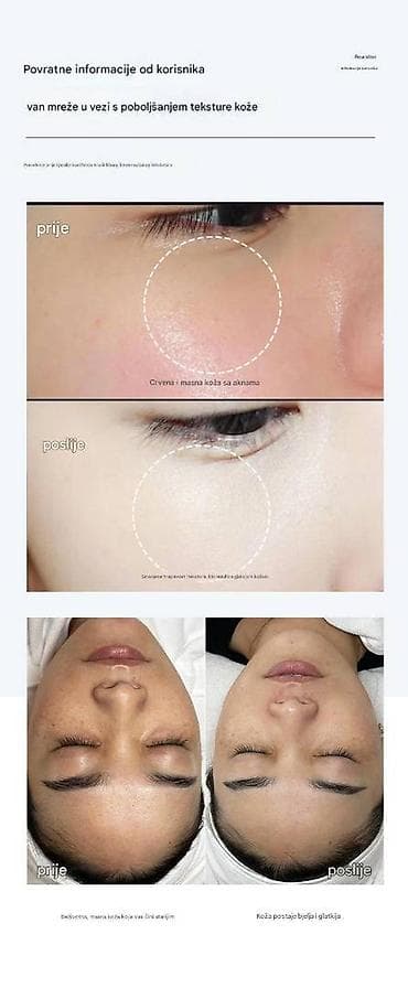 Dr. Oakes+ Facial SPA Atomizer – profesionalni uređaj za njegu lica sa na lalafo.rs — 9 Dr. Oakes+ Facial SPA Atomizer – profesionalni uređaj za njegu lica sa — 9