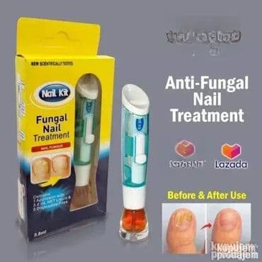 Nega noktiju: Fungal Nail tretman – efikasan protiv gljivica na noktima Dobrodošli u na lalafo.rs Nega noktiju: Fungal Nail tretman – efikasan protiv gljivica na noktima Dobrodošli u