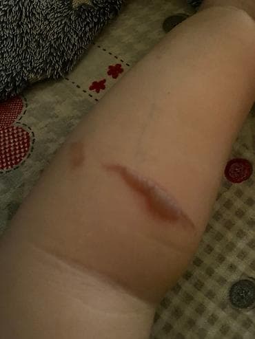 cepaci za drva: Trpezarijski set – sto i 4 stolice Cena kompleta 220e Stolica na lalafo.rs — 3 cepaci za drva: Trpezarijski set – sto i 4 stolice Cena kompleta 220e Stolica — 3