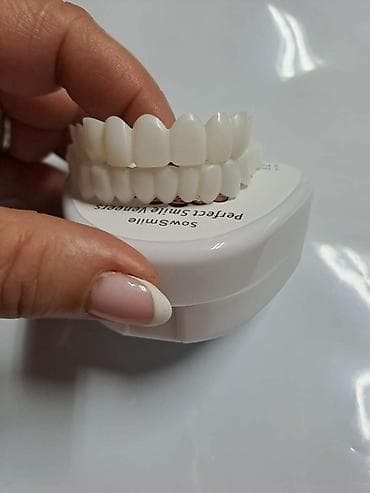 Snap on Smile navlake za zube Cena:2100din/par SowSmile na lalafo.rs — 2 Snap on Smile navlake za zube Cena:2100din/par SowSmile — 2