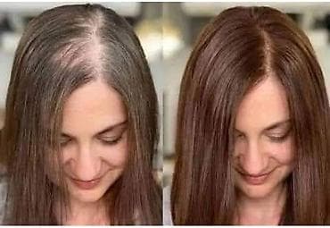 KOSALim – biljni losion za rast kose - Namenjen prorjeđivanju kose i na lalafo.rs — 1 KOSALim – biljni losion za rast kose - Namenjen prorjeđivanju kose i — 1