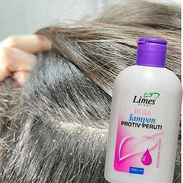 cista koza broj: ❄️ Šampon protiv peruti – čista kosa, zdravo teme! 🧴 Zaboravi na na lalafo.rs — 4 cista koza broj: ❄️ Šampon protiv peruti – čista kosa, zdravo teme! 🧴 Zaboravi na — 4