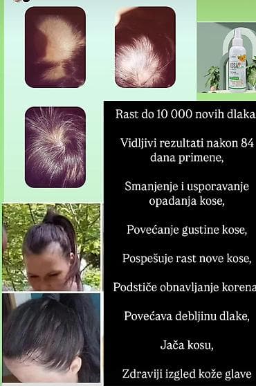 Nega kose na lalafo.rs — 1 Nega kose — 1