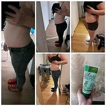 Limes Anti Celulit krema–gel, 200 ml Opis proizvoda: - Biljni na lalafo.rs — 2 Limes Anti Celulit krema–gel, 200 ml Opis proizvoda: - Biljni — 2