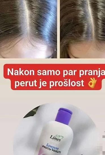❄️ Šampon protiv peruti – čista kosa, zdravo teme! 🧴 Zaboravi na na lalafo.rs ❄️ Šampon protiv peruti – čista kosa, zdravo teme! 🧴 Zaboravi na