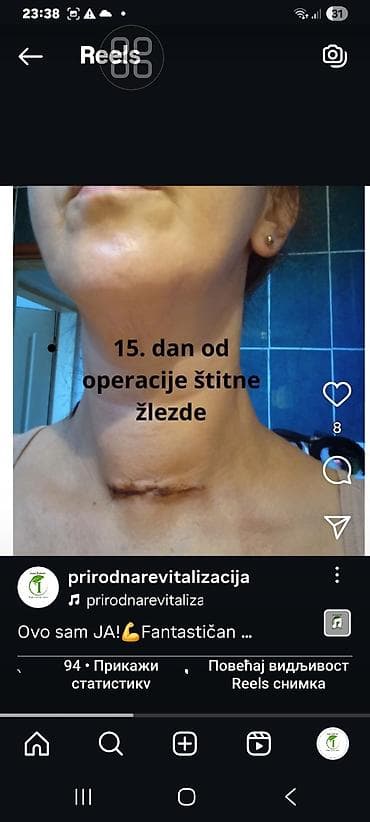 eko koza sa: KOREN BALSAM – Extra Rich Massage Balsam - Autentična formula iz srca na lalafo.rs — 3 eko koza sa: KOREN BALSAM – Extra Rich Massage Balsam - Autentična formula iz srca — 3