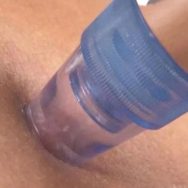 💎 Derma Suction čistač lica sa 4 rezervne glave 💎 🔥 Rešite se akni na lalafo.rs 💎 Derma Suction čistač lica sa 4 rezervne glave 💎 🔥 Rešite se akni