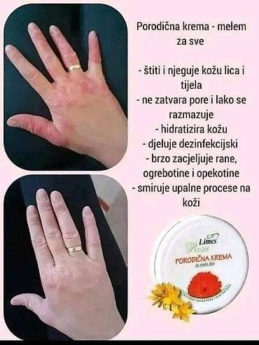 Limes Riza Porodična krema – melem za sve Opis: - Univerzalna krema na lalafo.rs — 2 Limes Riza Porodična krema – melem za sve Opis: - Univerzalna krema — 2