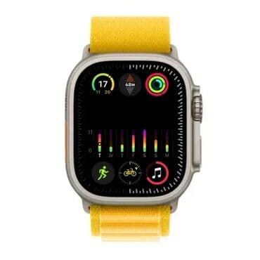 Narukvica za sat, bоја - Žuta na lalafo.rs Narukvica za sat, bоја - Žuta