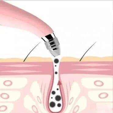 Aparati za čišćenje lica: Aparat za uklanjanje mitisera Profesionalni uređaj za nežno i na lalafo.rs — 2 Aparati za čišćenje lica: Aparat za uklanjanje mitisera Profesionalni uređaj za nežno i — 2