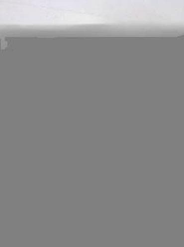 Car Parts: Alfa Romeo 147 1.6 TS BOMBINA. Alfa Romeo 147 1.6 TS BOMBINA at lalafo.rs — 2 Car Parts: Alfa Romeo 147 1.6 TS BOMBINA. Alfa Romeo 147 1.6 TS BOMBINA — 2