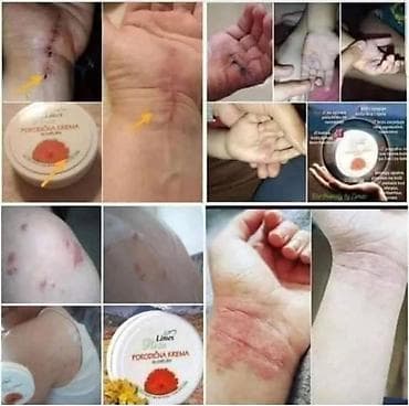 Porodična krema – melem za svaki dan (Limes Rossa) - Višenamenska na lalafo.rs — 2 Porodična krema – melem za svaki dan (Limes Rossa) - Višenamenska — 2