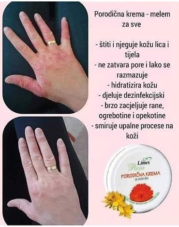 Porodična krema – melem za svaki dan (Limes Rossa) - Višenamenska na lalafo.rs — 1 Porodična krema – melem za svaki dan (Limes Rossa) - Višenamenska — 1