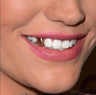 I najzad ko voli nek izvoli ZLATNI ZUB!!! U paketu dobijate 1 zub i na lalafo.rs I najzad ko voli nek izvoli ZLATNI ZUB!!! U paketu dobijate 1 zub i